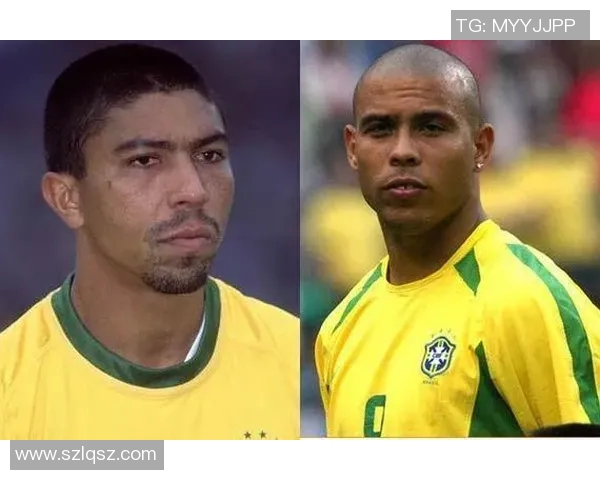 足球明星脱发问题揭秘那些曾经风光无限的球员如今发量骤减 足球明星脱发问题揭秘那些曾经风光无限的球员如今发量骤减